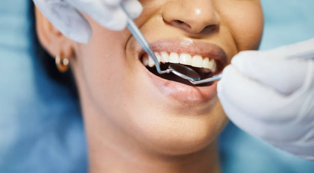 Best Dental Abscess Treatment in Grand Blanc, MI