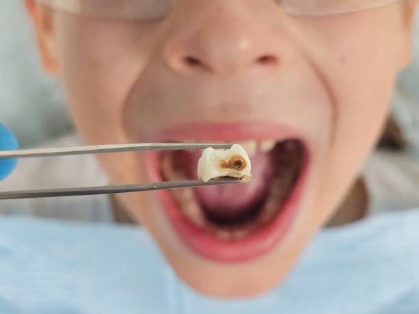 Best Emergency Root Canal Therapy in Grand Blanc, MI